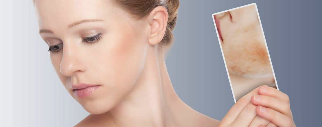 Top 5 products for getting redness under control.