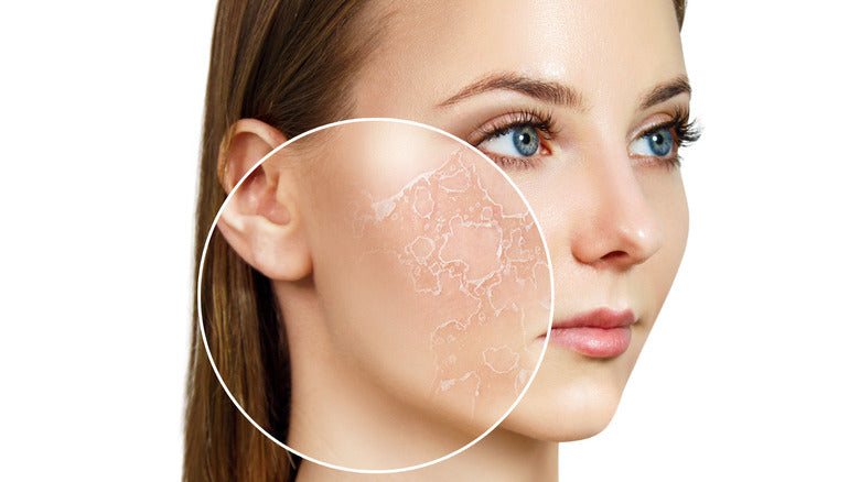 Dry or dehydrated skin - whats the difference?