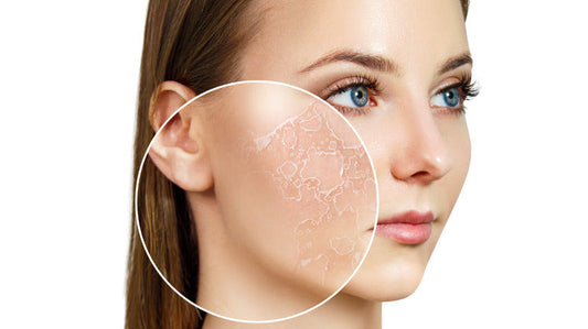 Dry or dehydrated skin - whats the difference?